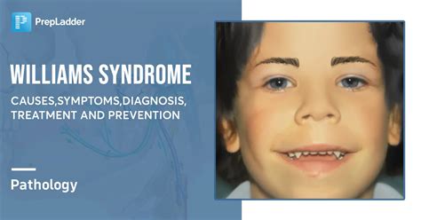 Williams Syndrome Causes Symptoms Diagnosis Treatment And Prevention
