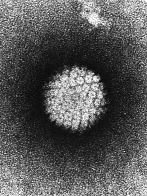 Electron Micrograph Of Human Papillomavirus Biology Of Humanworld Of