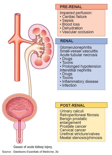 Causes Of Acute Kidney Injury Aki Prerenal Renal Grepmed