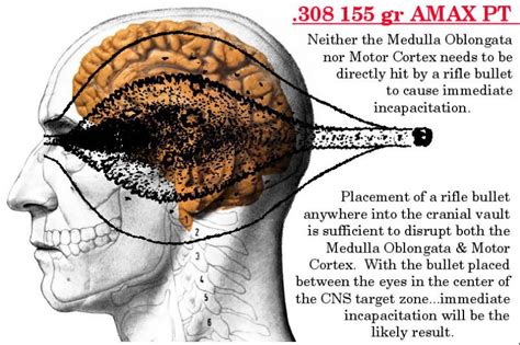 He had a.50 cal flesh wound on his inner thigh. Pin by Isaiah Vigil on Ammo and Ballistics | Motor cortex ...