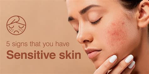 Sensitive Skin How To Tell If You Have Sensitive Skin