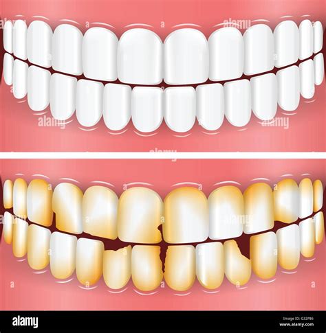 Open Mouth Dental Teeth Chart