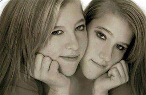 Unusual Facts About Famous Conjoined Twins Abby And Brittany Hensel