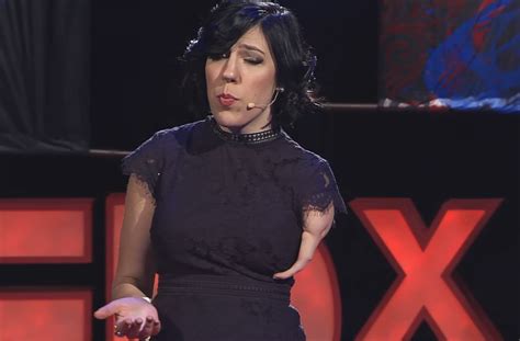 Amputee Tedx Talks You Probably Missed Amplitude
