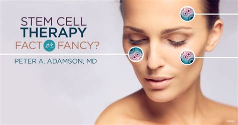 Stem Cell Facelifts Are They For Real Adamson Md Associates