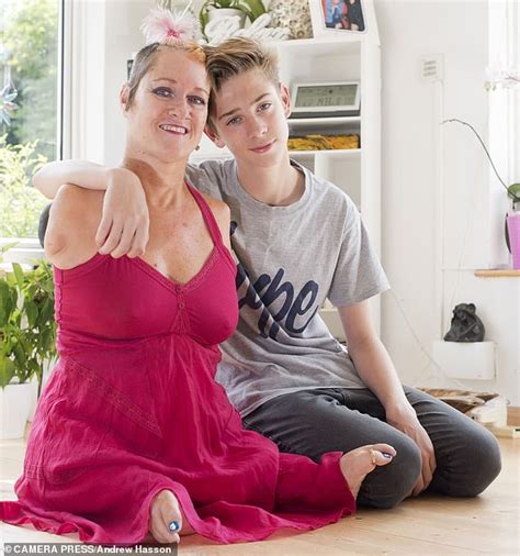 Alison Lapper Reveals Her Son Struggled With School Bullies Before His
