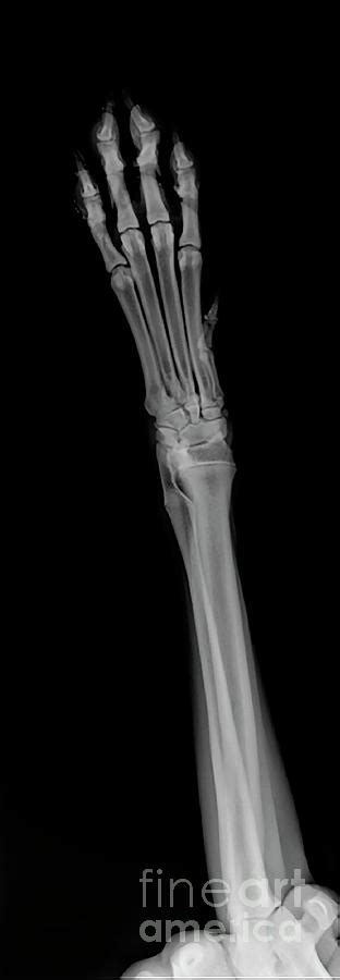 X Ray Of A Dogs Front Right Leg Photograph By Yael Rosen Pixels