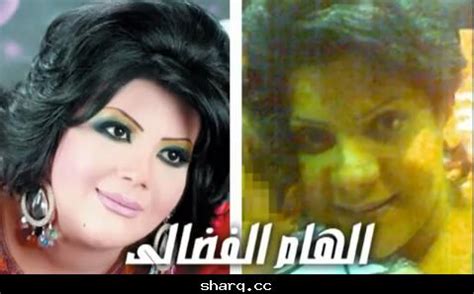 صور الفنانات قبل وبعد عمليات التجميل والشهره والمكياج. صور ممثلات قبل وبعد عمليات التجميل