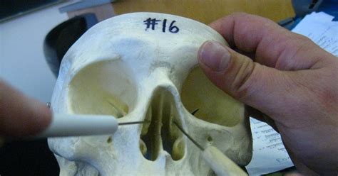 Boned: Human Skull - nasal conchae (of ethmoid bone)