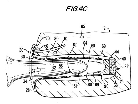 Patent Us Female Barrier Contraceptive With Vacuum Anchoring