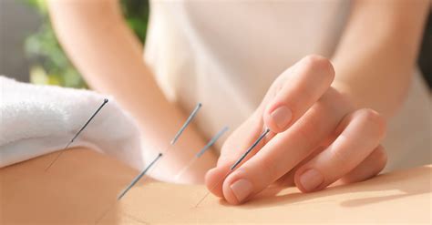 Acupuncture • Massage Therapy • Facial Treatments Health Within