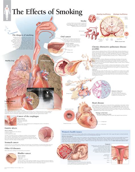 One of the symptoms of lung cancer may be pain in the chest, shoulder, or back area. Effects of Smoking - Scientific Publishing