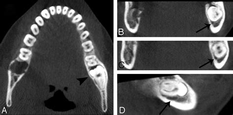 Conebeam Ct Of The Head And Neck Part 2 Clinical Applications