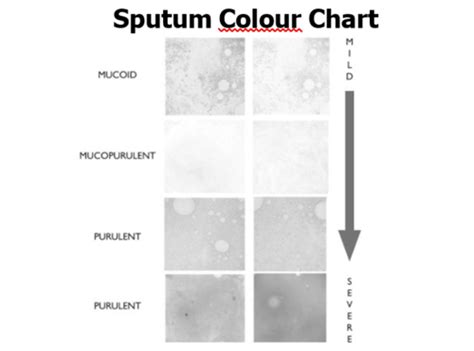 Sputum Colour Chart