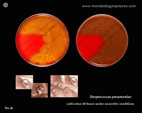 Streptococcus Pneumoniae Anaerobic Cultivation And Colony Appearance