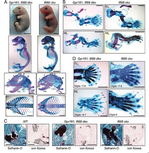 Figure 8 From The G Protein Coupled Receptor Gpr161 Regulates Forelimb