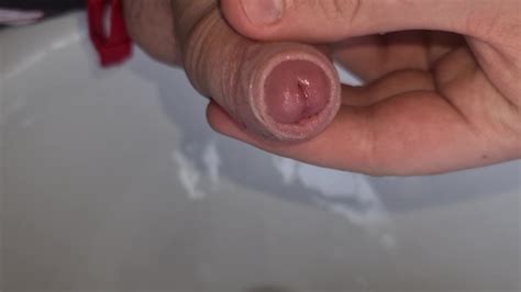 19 Uncut Soft Cock Foreskin Play Xxx Mobile Porno Videos And Movies Iporntvnet