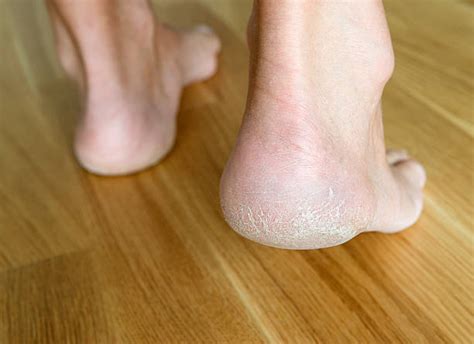 Check spelling or type a new query. Mature Soles Stock Photos, Pictures & Royalty-Free Images ...