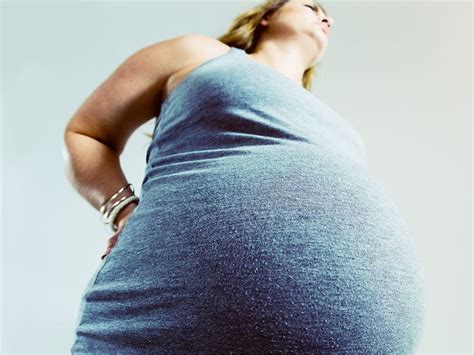 Obesity Tied To Adverse Pregnancy Outcomes In Mentally Ill Women