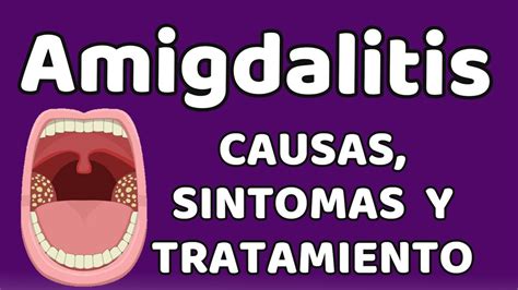 La Amigdalitis Causas Signos Y Síntomas Diagnóstico Y Tratamiento