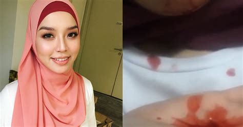 Penyebab keluar darah dari dubur. Darah Keluar Dari Mulut Tanpa Henti, Nonny Nadirah Minta ...