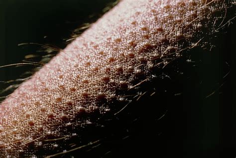 Close Up Of Goose Bumps On Skin Of Forearm Photograph By Martin Dohrn