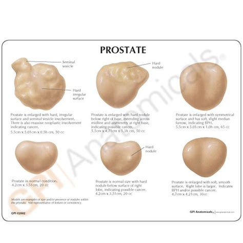 Volume Prostata Normal Cm3