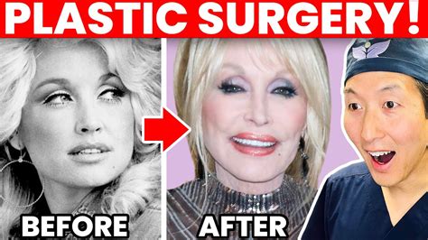 Plastic Surgeon Reacts To Dolly Partons Cosmetic Surgery