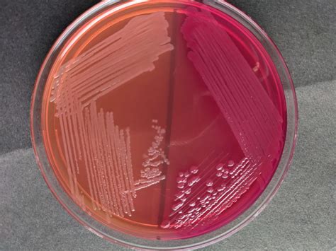 MacConkey Agar Composition Uses Colony Characteristics