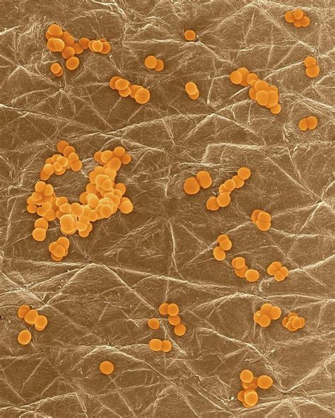 Staphylococcus Aureus On Human Skin 12 Photograph By Dennis Kunkel Microscopyscience Photo