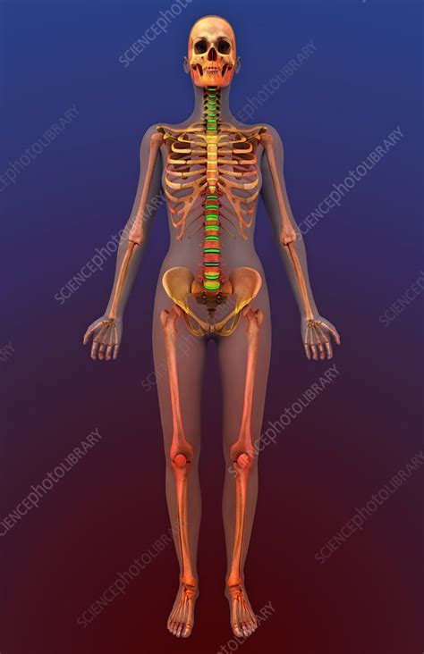 There are two kinds of fracture: Female skeleton - Stock Image - C007/9720 - Science Photo Library