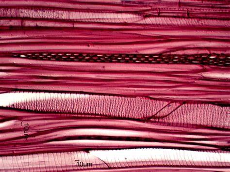Tilia Americana American Basswood Tangential Section Under The Microscope