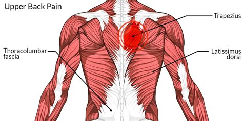 Upper Back Muscles Diagram Pain