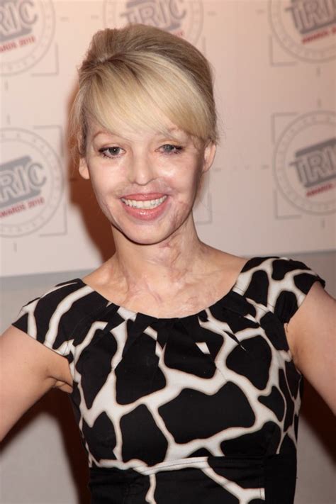 What Katie Piper Has Said As Acid Attacker Is Released From Prison