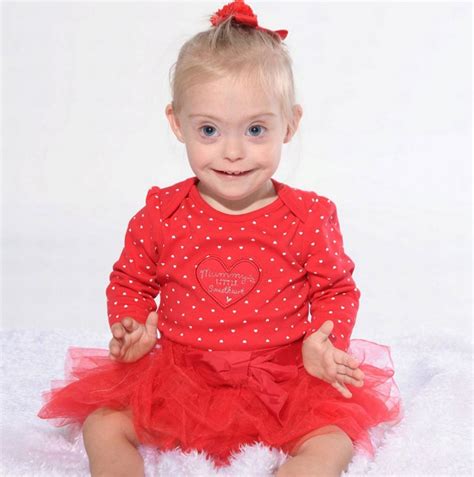 Two Year Old Girl With Down Syndrome Became A Model Thanks To Her Radiant Smile Pictolic