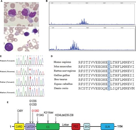 Frontiers Identification And Characterization Of A Germline Mutation