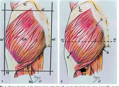 Figure 1 From Surgical Anatomy Of The Gluteal Region S Subcutaneous