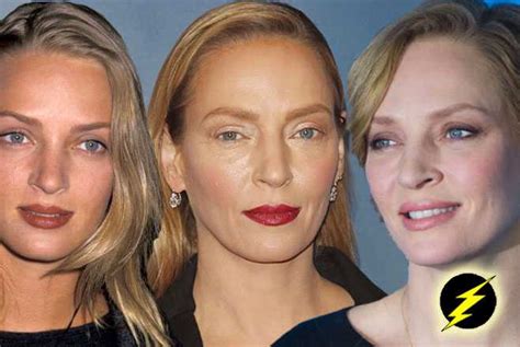 Uma thurman has long been known as one of the most distinctive faces in hollywood. Uma Thurman—Plastic Fantastic Or Au Naturel? Top Surgeon ...
