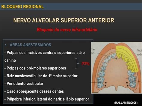 Bloqueio Anestesico Do Nervo Alveolar Superior Poster