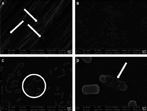 Listeria is a rare but sometimes fatal disease people contract from eating infected food. Field emission scanning electron microscopy images of ...