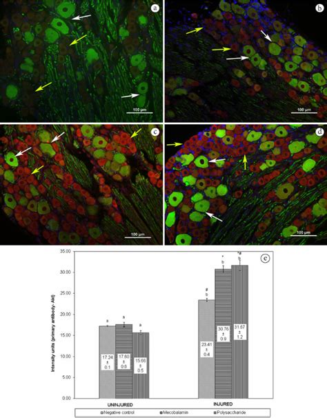 One is usually front l/r one is rear l/r and another is center/sub. Akt activation in DRG neurons after crush injury. Double ...