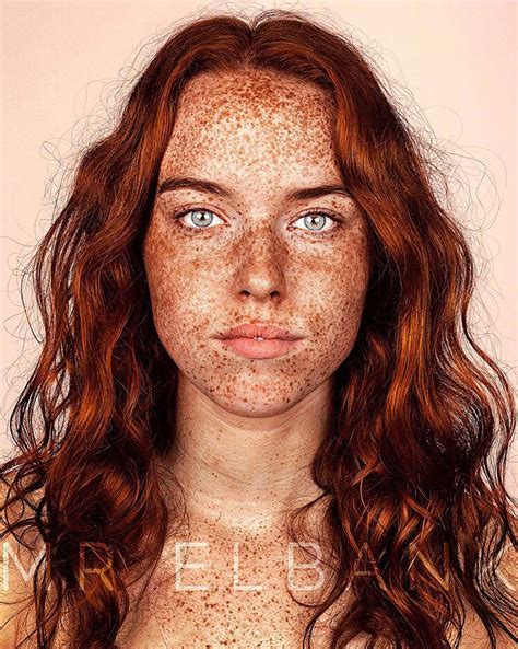 15 Fotos Que Demuestran Que Las Personas Con PECAS Son Hermosas