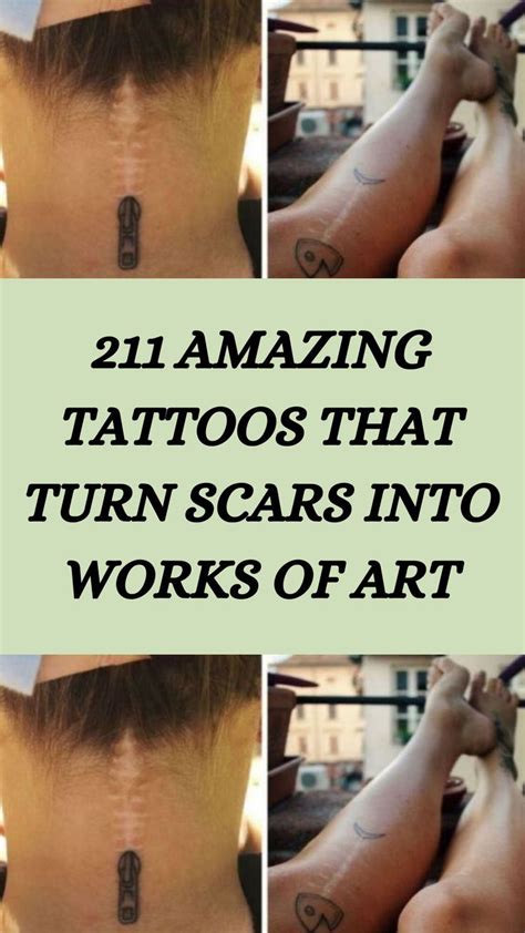 211 Amazing Tattoos That Turn Scars Into Works Of Art Artofit