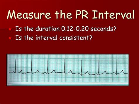 Ppt How To Read An Ekg Powerpoint Presentation Free Download Id All