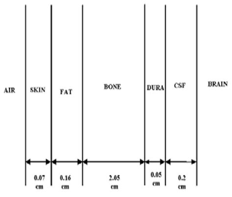 The Six Layer Human Head Model 7 Download Scientific Diagram