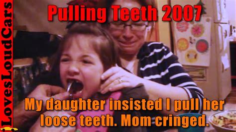 Pulling Daughters Teeth With Pliers Youtube