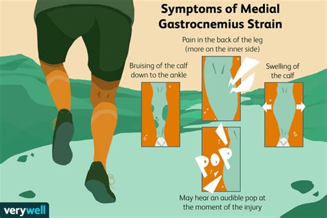 Medial Gastrocnemius Strain Overview And Treatment