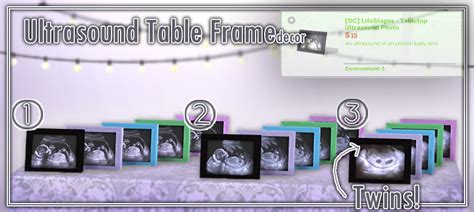 My Sims 4 Blog Ultrasound Table Frames By Devoidcreations
