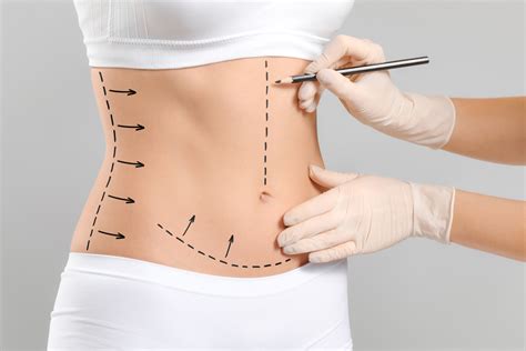 Tummy Tuck Techniques Traditional Vs Mini Tummy Tuck