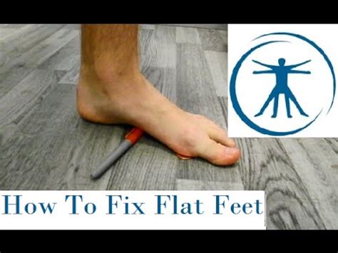 This can be fixed through doing daily foot exercises to strengthen if the condition of flat feet is getting to be severe, there is no other option but consider surgical intervention. How To Fix Flat Feet (Fallen Arches) With Correction ...